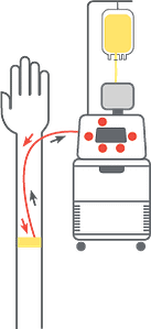 Apheresis Platelets Diagram